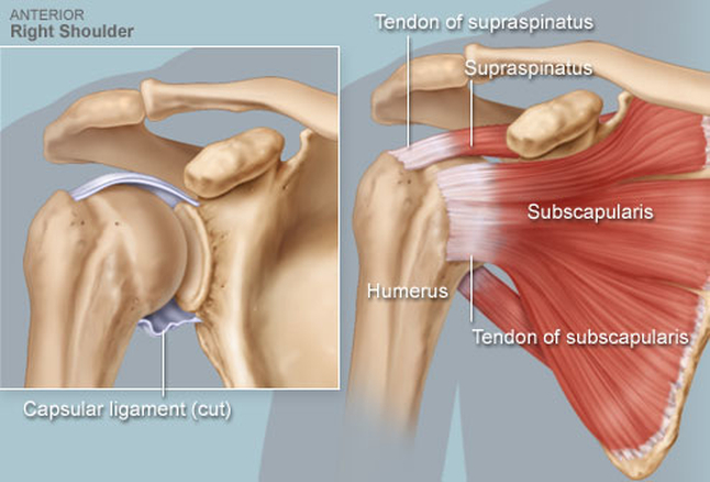 vállfájdalomra torna artrózis 3 fokos térdízület kezelési áttekintés